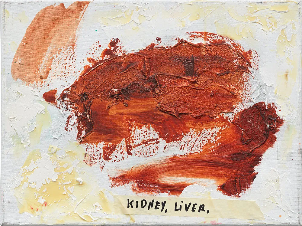 Digestion — Henrik Olesen — Exhibitions — Galerie Buchholz — Image 00